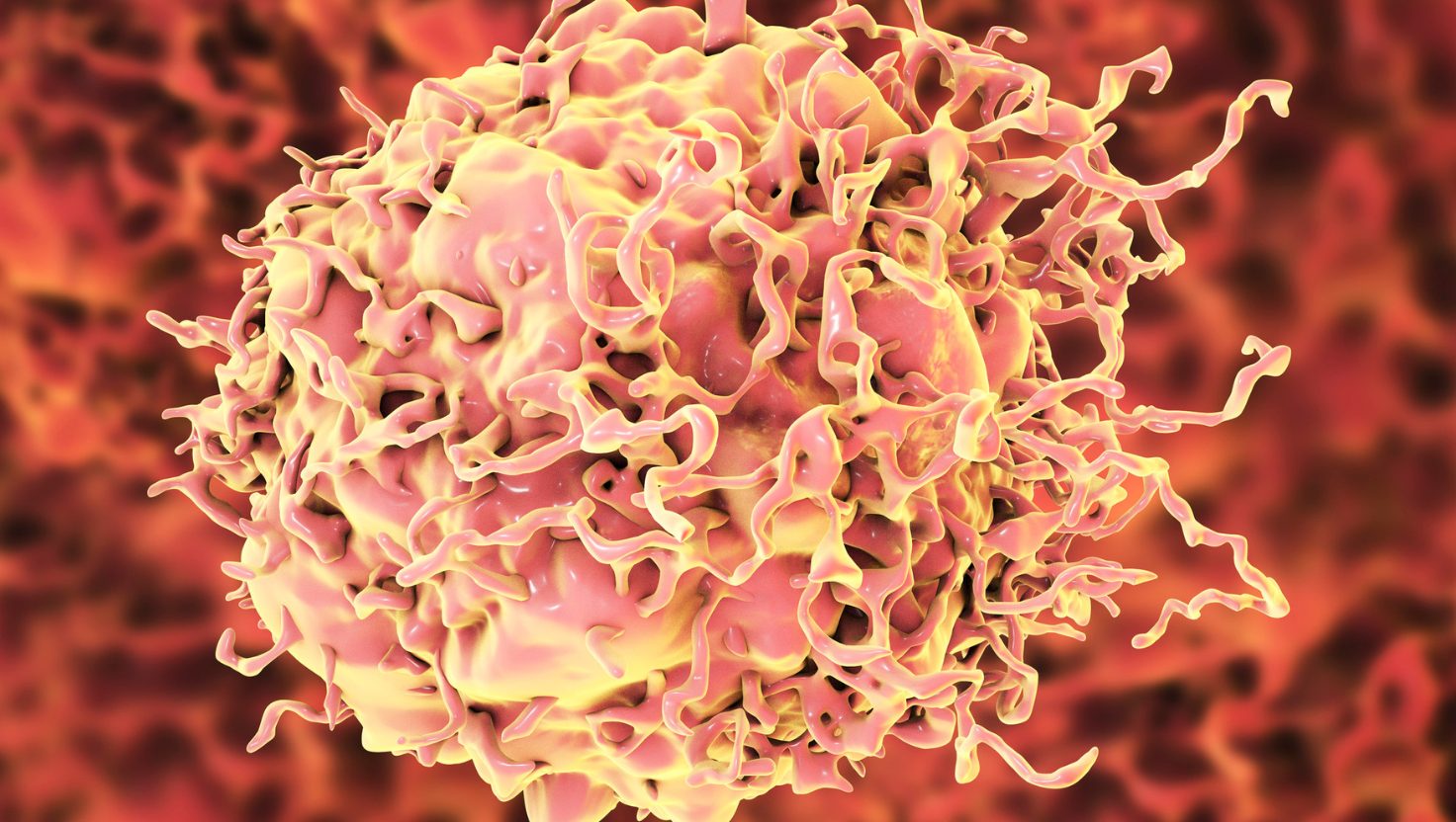 Colorectal Cancer in Australia